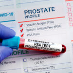 Blood sample tube for analysis of PSA Prostate Specific Antigen profile test in laboratory. Prostate Cancer Screening